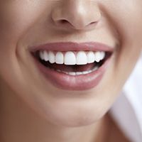 close up of person smiling with straight white teeth 