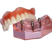 implant-supported denture