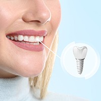 A photo pointing out a woman’s implanted tooth