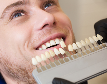 Man’s smile compared with color shade chart