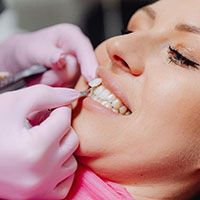 Woman at consultation for veneers