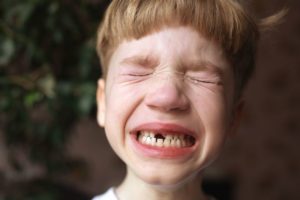 boy crying after tooth knocked out