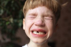 boy crying after tooth knocked out 